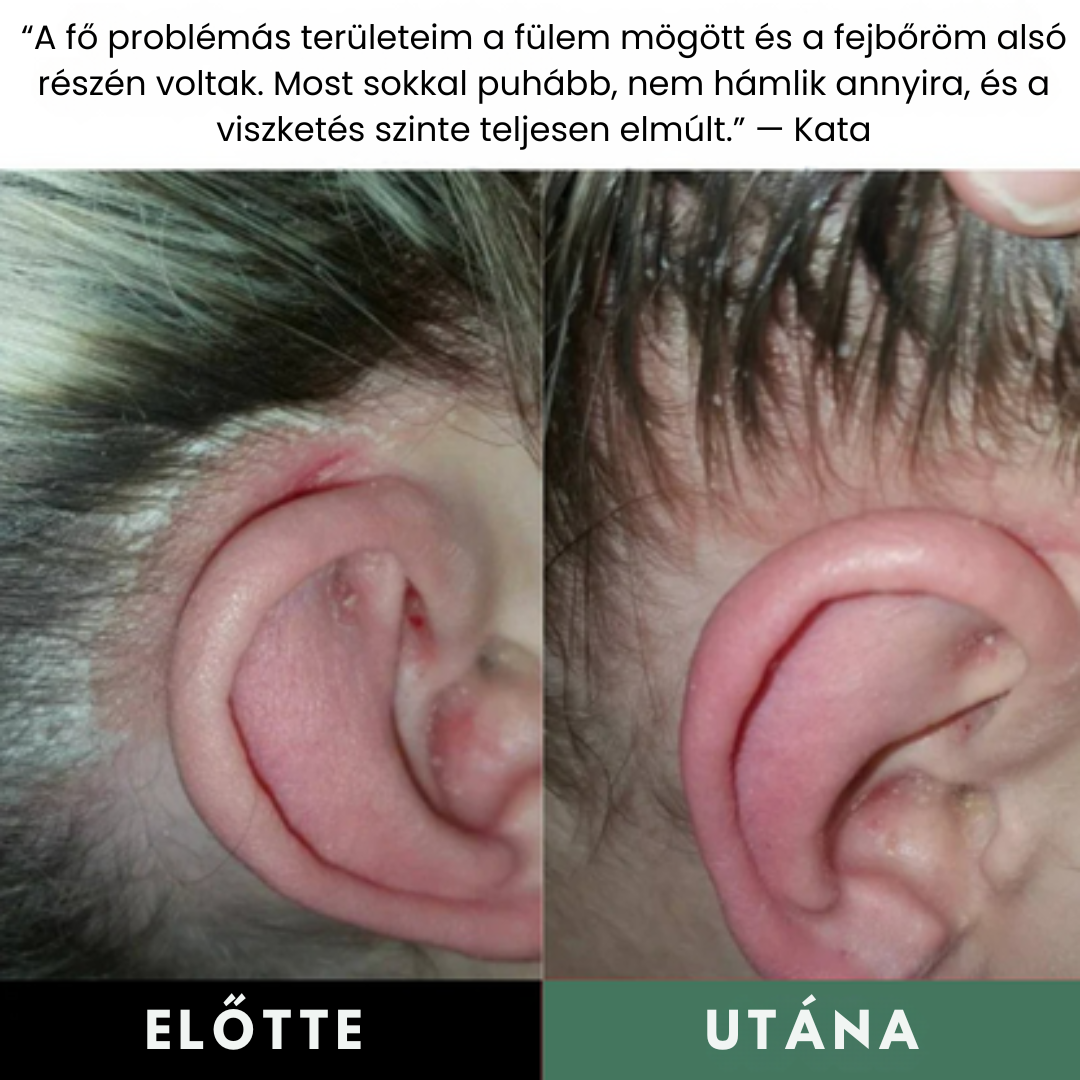 Természetes Fejbőrradír